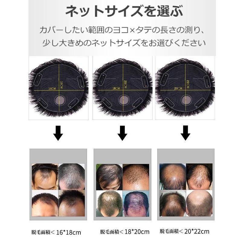 巻き毛