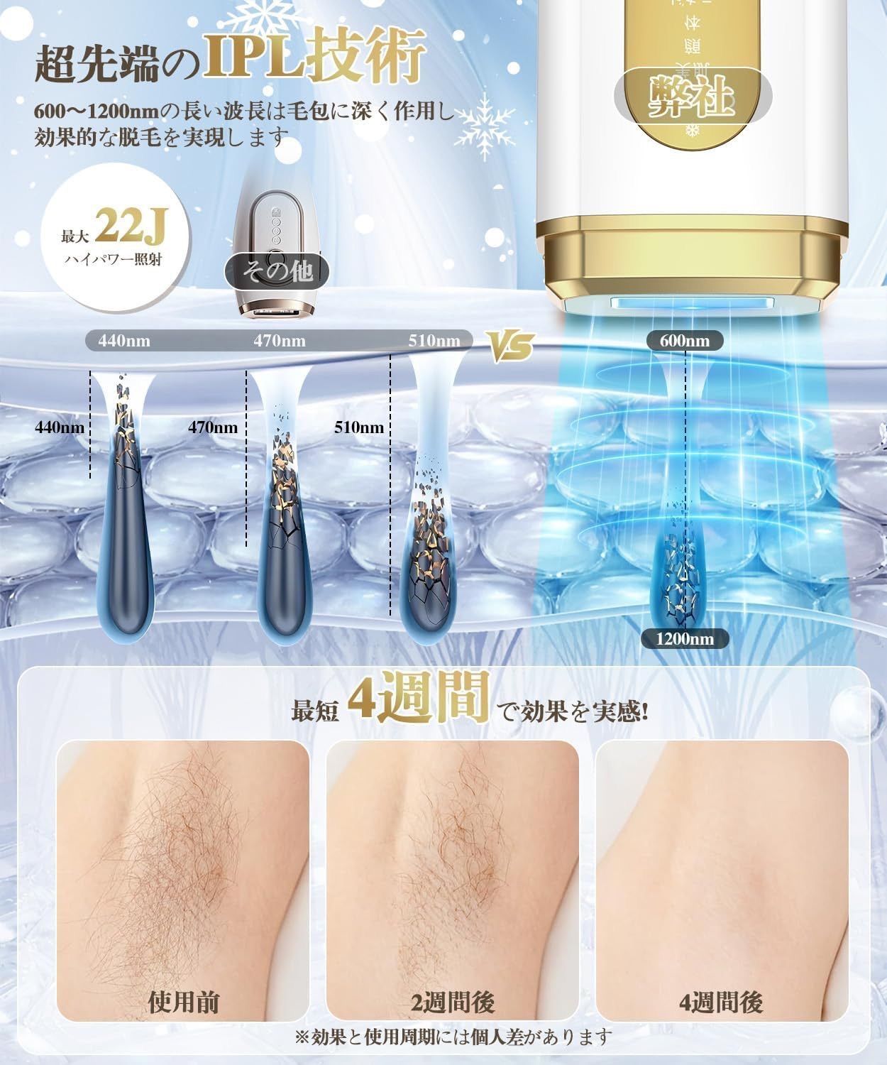 【大特価】Clyrox 脱毛器 VIO対応PSE安全認証済み Amazon.co.jp: Clyrox 脱毛器 VIO対応【2025年夏新モデル・IPL