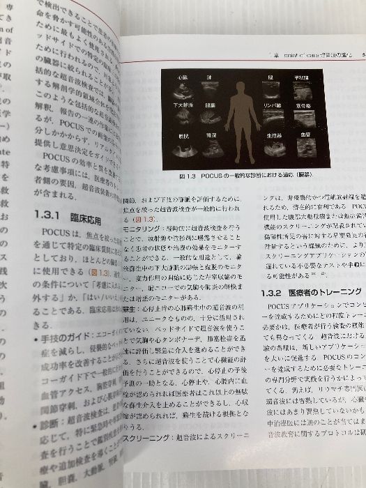 【中古】 ＰｏｉｎｔーｏｆーＣａｒｅ超音波 電子書籍（日本語・英語版）付 原書第２版/エルゼビア・ジャパン/ニラム・Ｊ．ソニ 71o7TW1rh5L._UF894,1000_QL80_.jpg