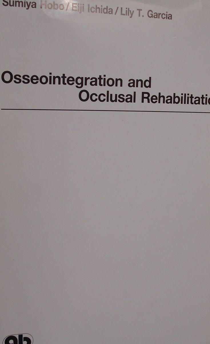 オッセオインテグレーテッド オッセオインテグレーション – インプラント安定性と治癒の解説 - Osstell®
