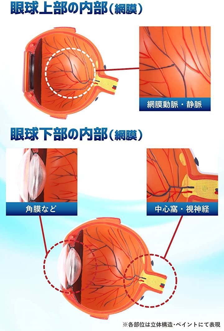 解剖 水晶体 模型 医学模型 眼球断面と白内障 GPI Anatomicals