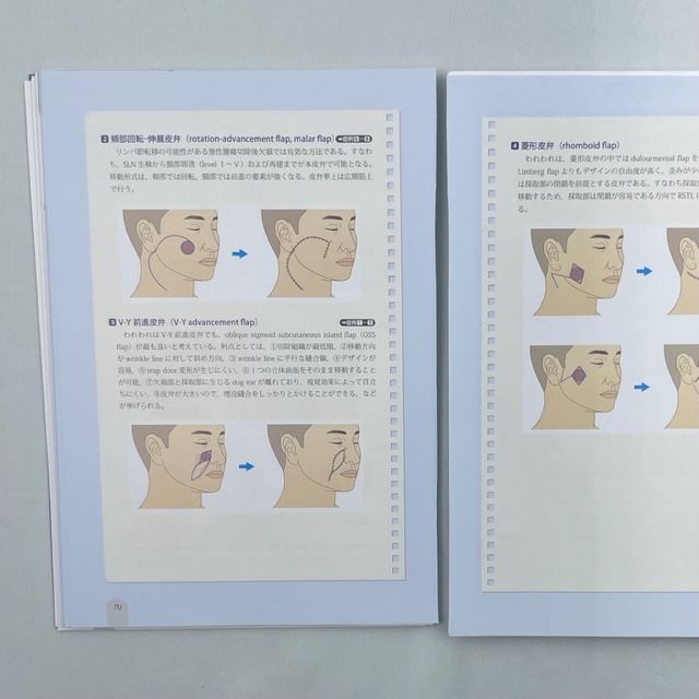 裁断済】局所皮弁〈第1巻〉顔面・頸部・体幹 - 裁断本卸売センター