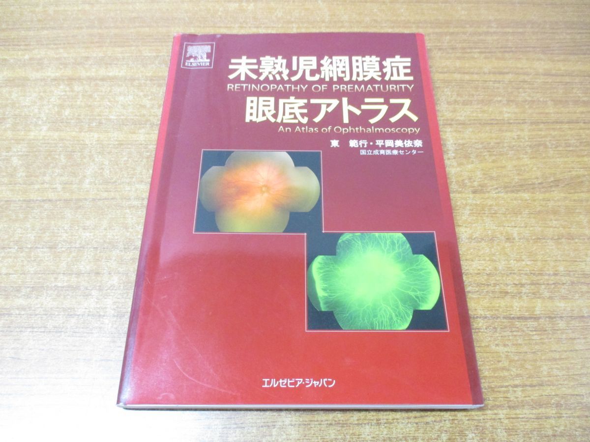 ▲01)【同梱不可】未熟児網膜症眼底アトラス/東範行/平岡美依奈/エルゼビア・ジャパン/2009年発行/A