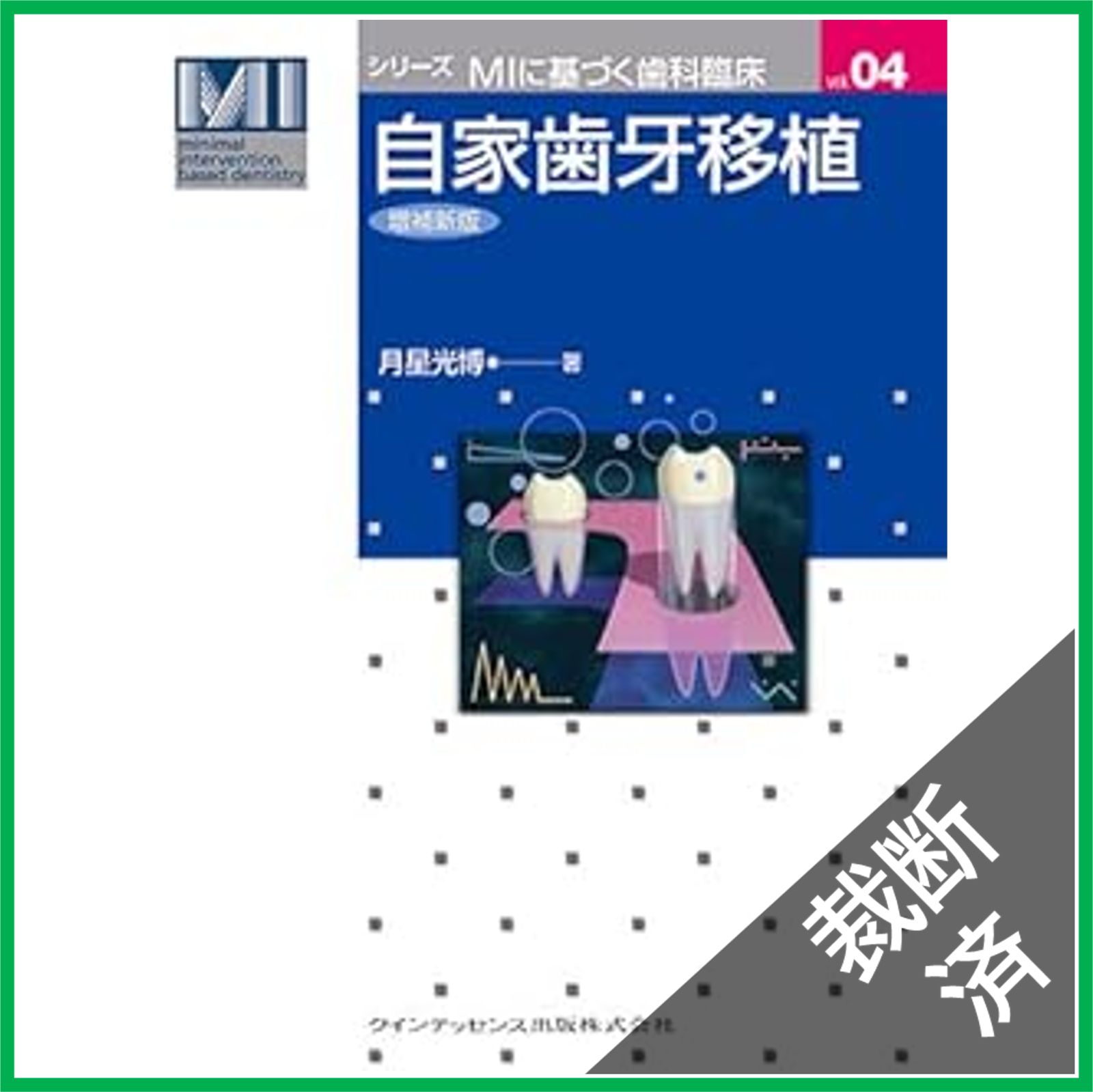 裁断済】自家歯牙移植 増補新版 (シリーズ MIに基づく歯科臨床