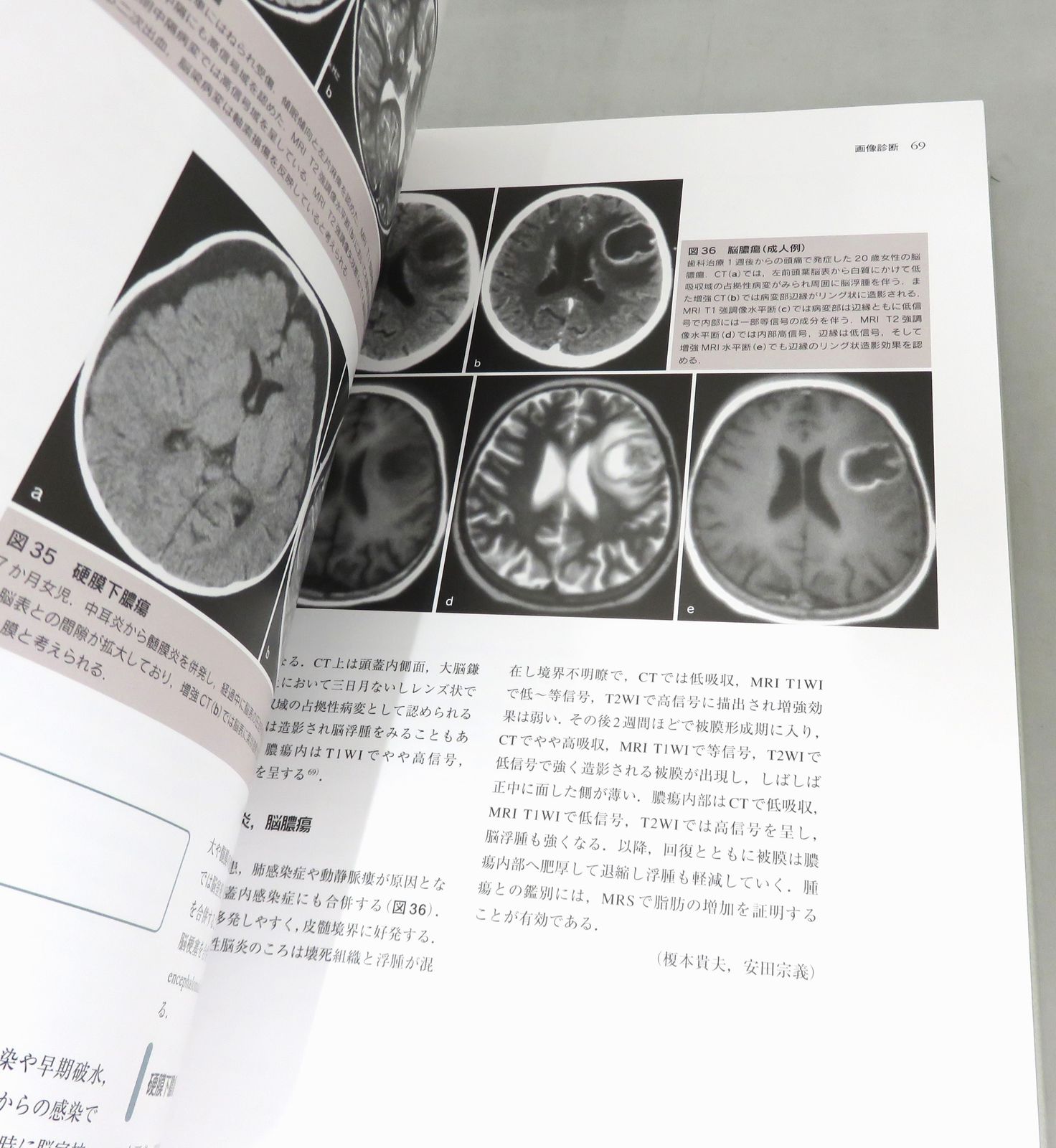 小児脳神経外科学 小児脳神経外科学 改訂2版 m3電子書籍 | 小児脳神経