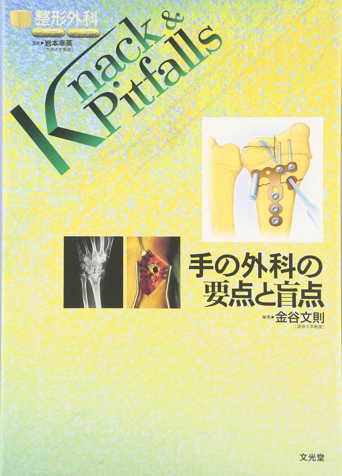  手の外科の要点と盲点 (整形外科knack u0026 pitfalls) その他