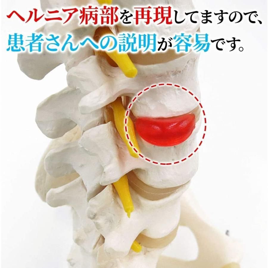 脊髄神経根 椎骨動脈
