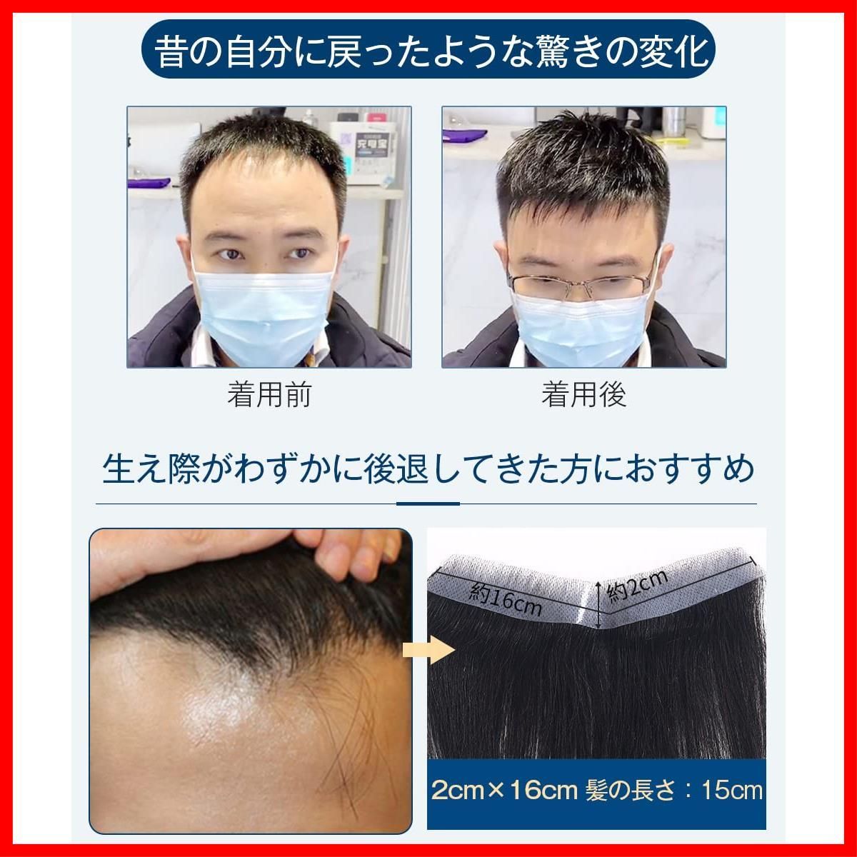 円形脱毛症隠し 增毛シート
