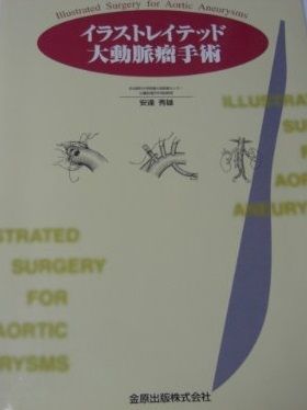イラストレイテッド大動脈瘤手術 安達 秀雄 イラストレイテッド大動脈瘤手術 安達 秀雄 【公式通販】