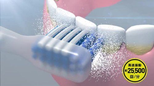 音波電動歯ブラシ