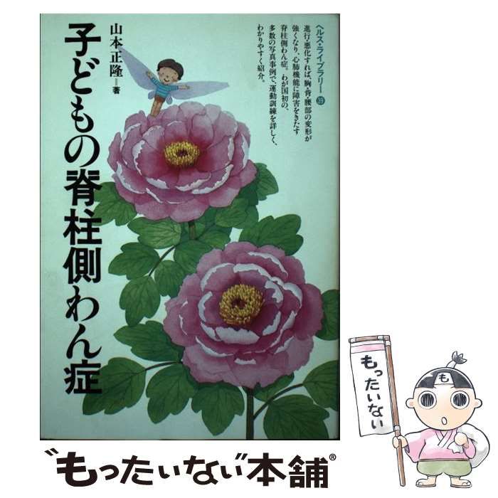 【中古】 子どもの脊柱側わん症 (ぎょうせいヘルス・ライブラリー 39) / 山本正隆 / ぎょうせい