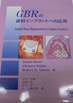 GBRの歯科インプラントへの応用 GBRの歯科インプラントへの応用