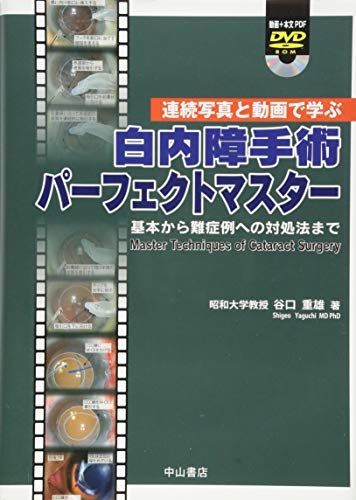 連続写真と動画で学ぶ 白内障手術パーフェクトマスター ―基本から難症例への対処法まで― [動画+本文PDF]DVD付 [単行本] 谷口重雄
