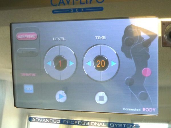 参考151万円 早い者勝ち CAVI-LIPO DEX-V キャビリポ デックスブイ 