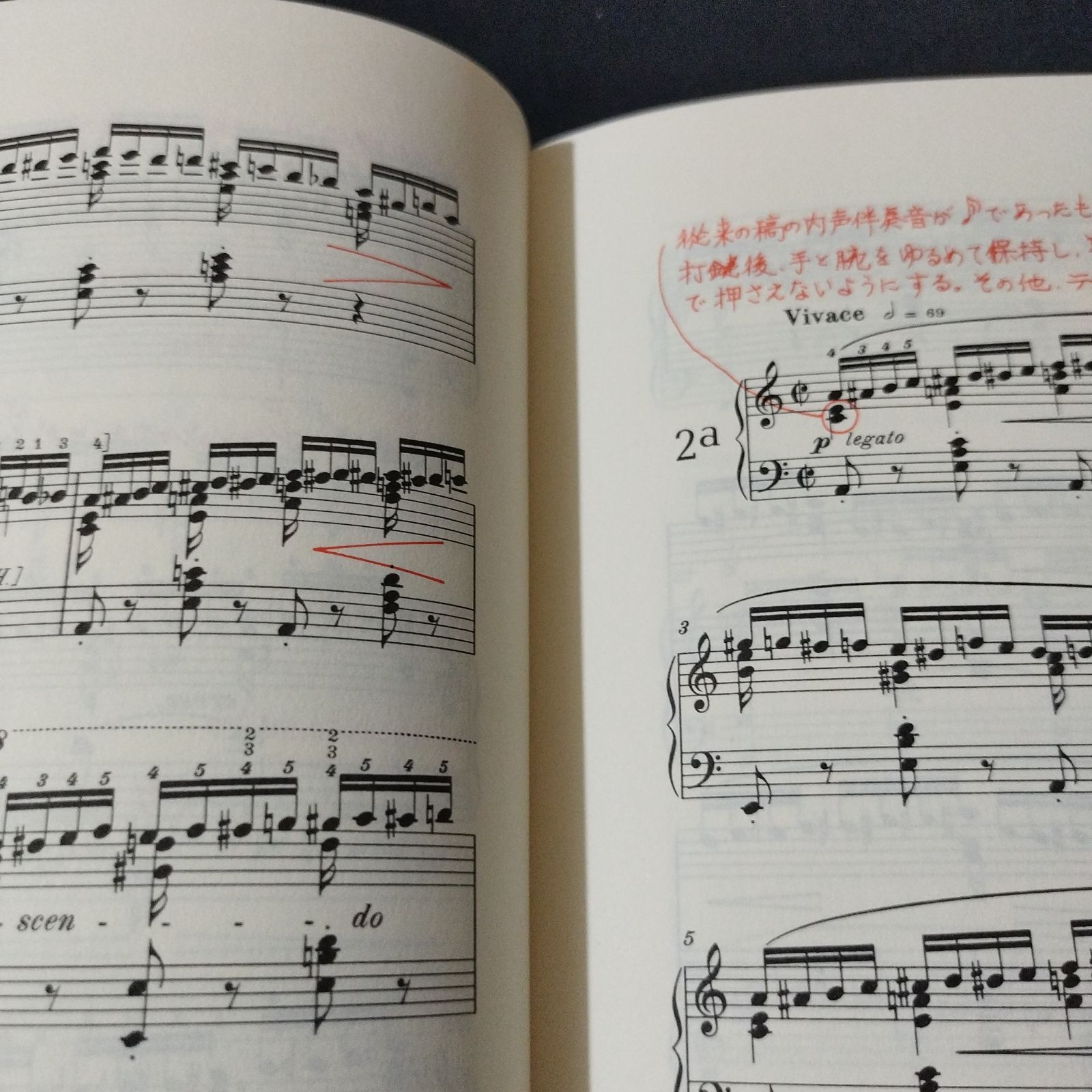 ムジカノーヴァ ピアノレッスンシリーズ　ショパン　ブルグミュラー他　5冊セット ムジカノーヴァ ピアノレッスンシリーズショパンブルグミュラー