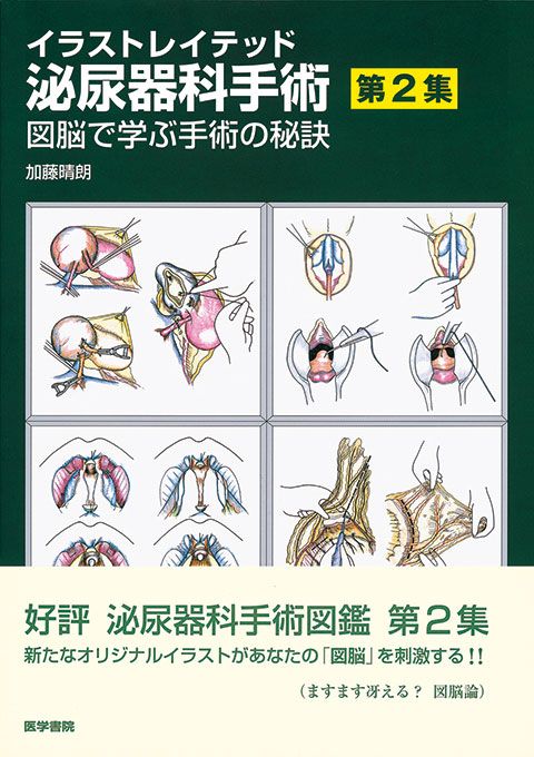 【裁断済】 イラストレイテッド泌尿器科 二冊セット イラストレイテッド泌尿器科手術（第2集） - メルカリ