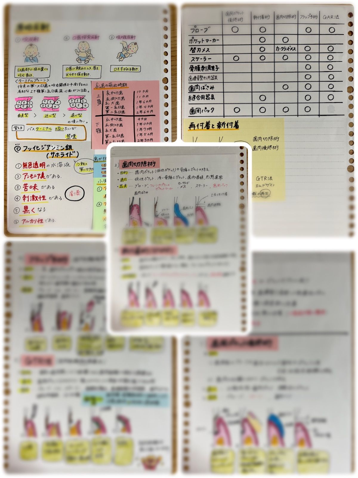 歯科衛生士 国家試験 勉強ノート まとめノート DH - メルカリ