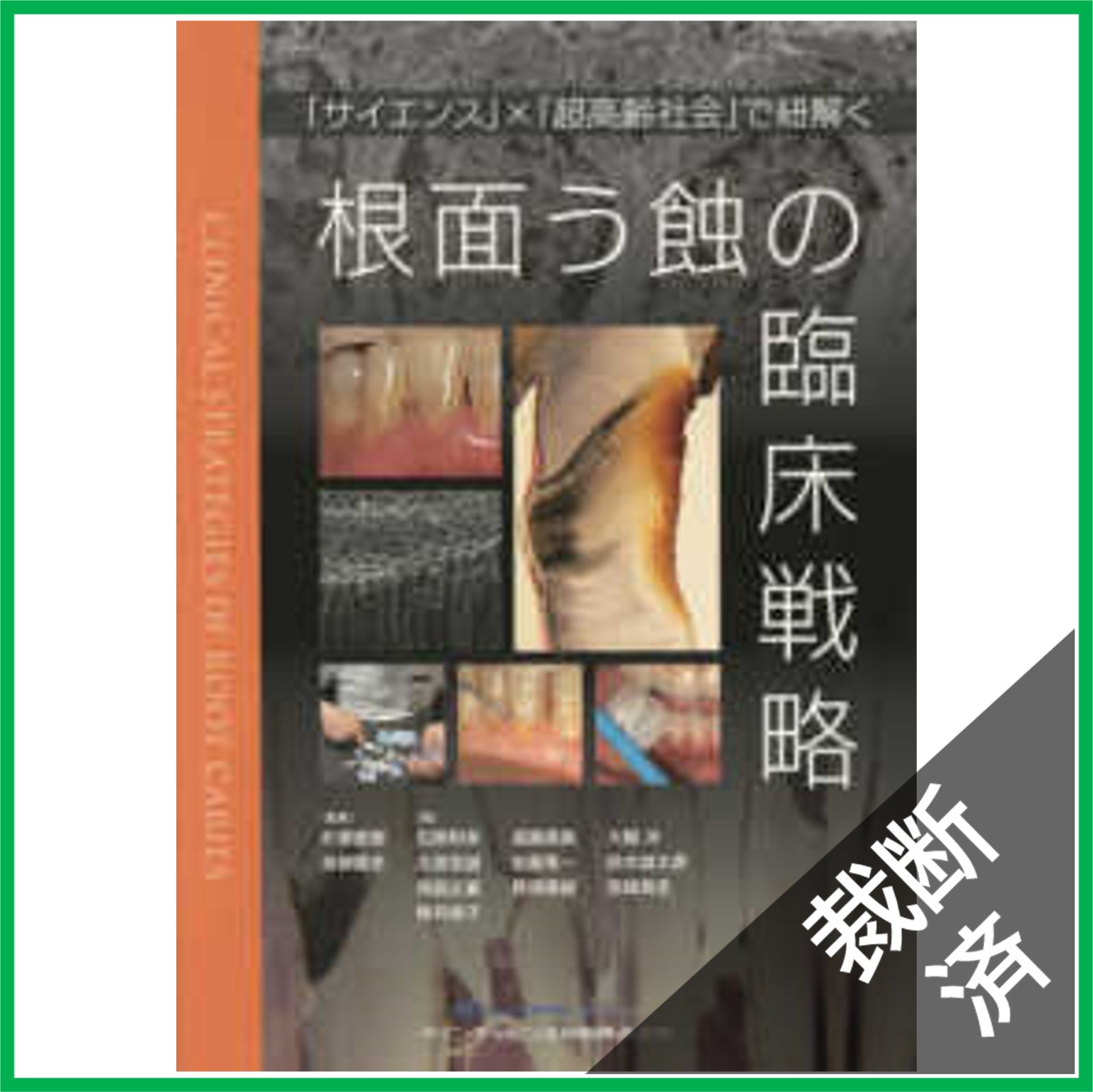裁断済】根面う蝕の臨床戦略 - 「サイエンス」×「超高齢社会」で