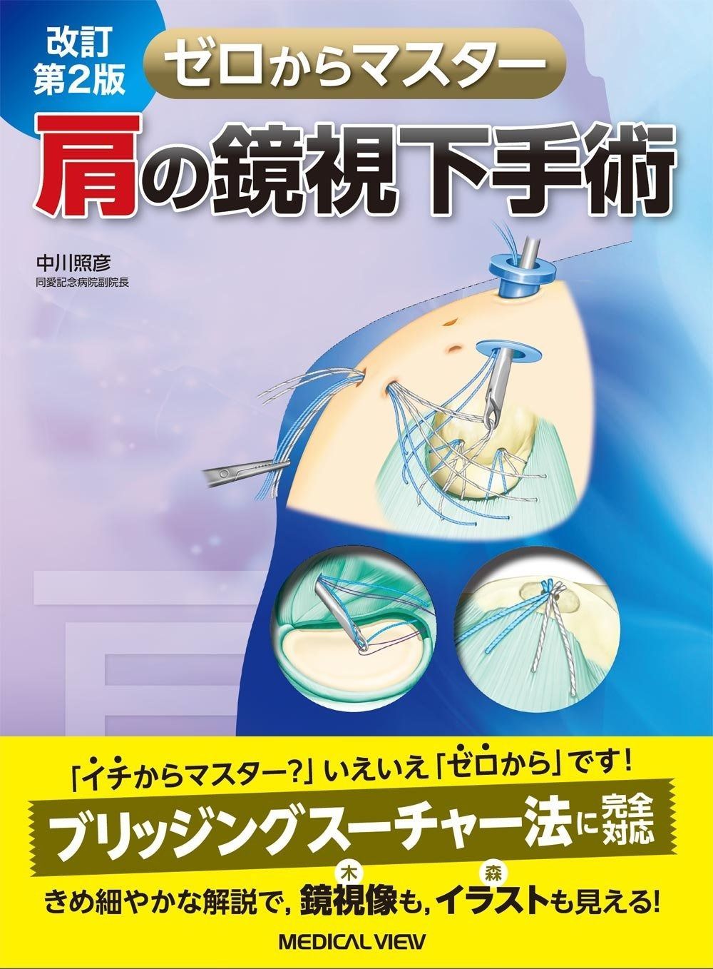 肩の鏡視下手術 改訂第2版 ゼロからマスター