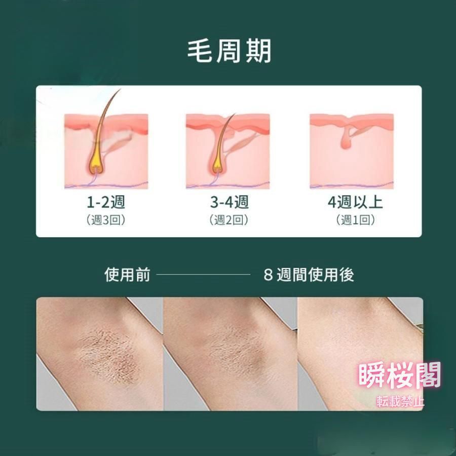 メンズ ipl光脱器
