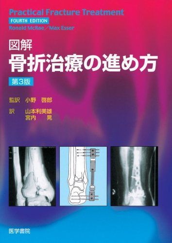図解骨折治療の進め方 3版