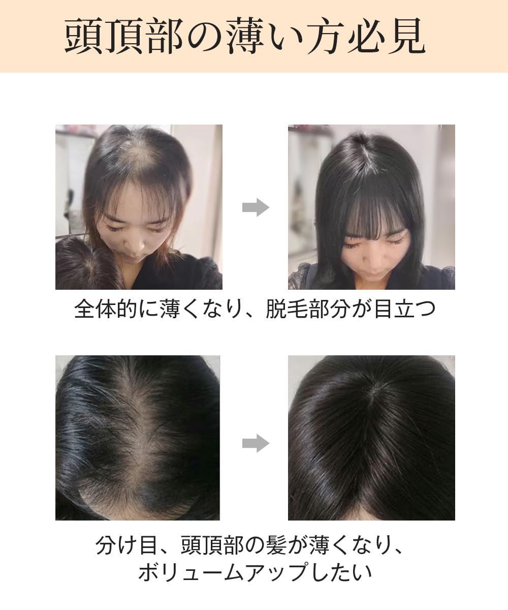 トップカバー