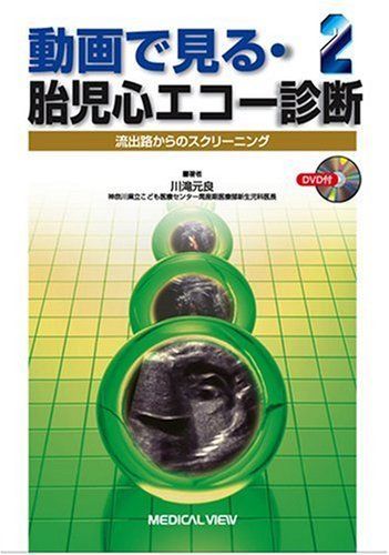 動画で見る・胎児心エコー診断 2?流出路からのスクリーニング 川滝 元良