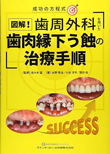 図解 歯周外科を用いた歯肉縁下う蝕の治療手順