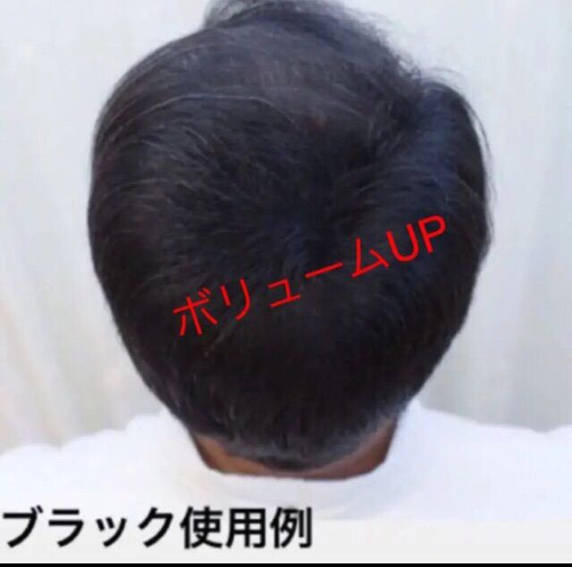 薄毛増毛ふりかけパウダー詰め替え用お得4個セット脱毛症分け目