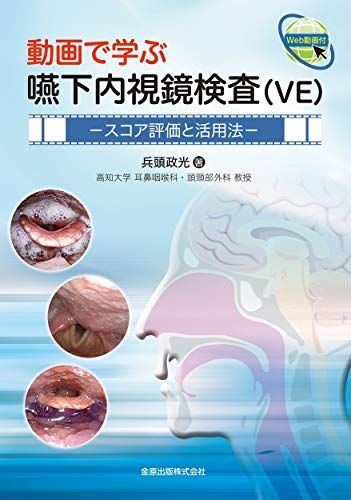 動画で学ぶ嚥下内視鏡検査(VE): スコア評価と活用法