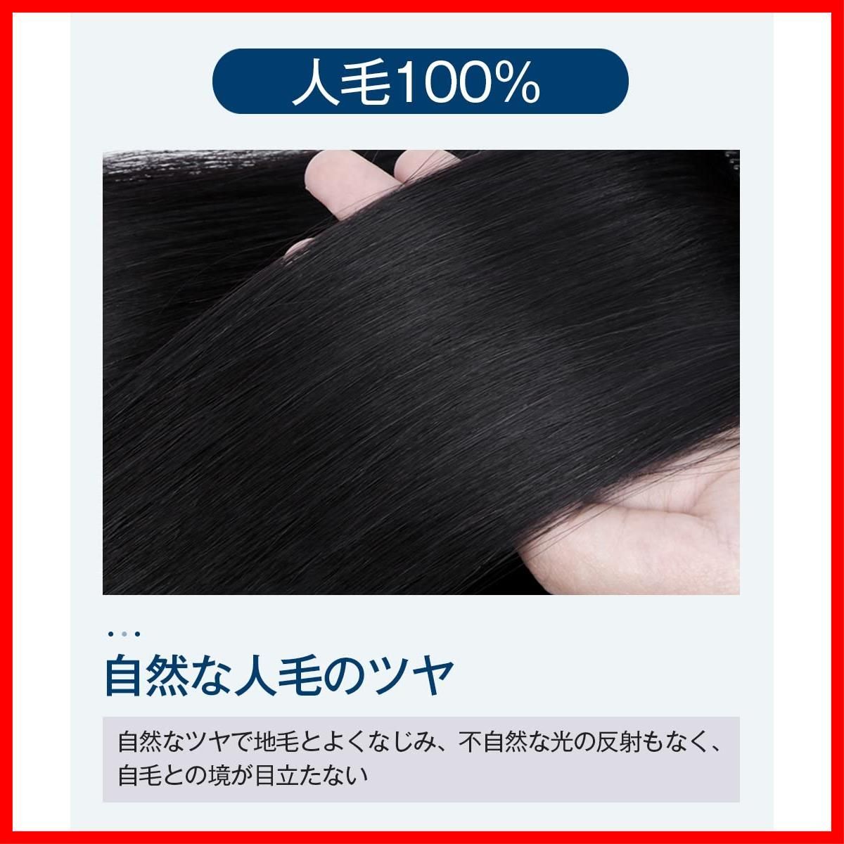 通気性 びまん性脱毛症