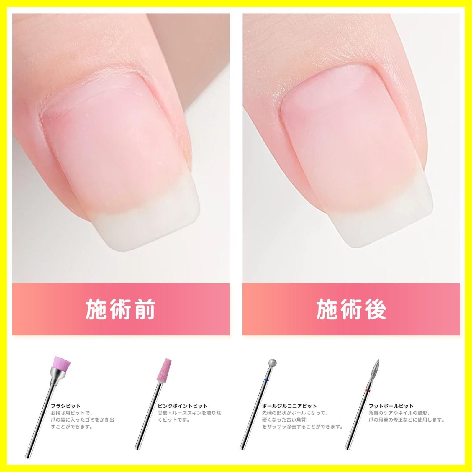 Annhua ネイルビット ネイルマシン ビット 10種類 セラミック Annhua ネイルビット ネイルマシン ビット 10種類 セラミック