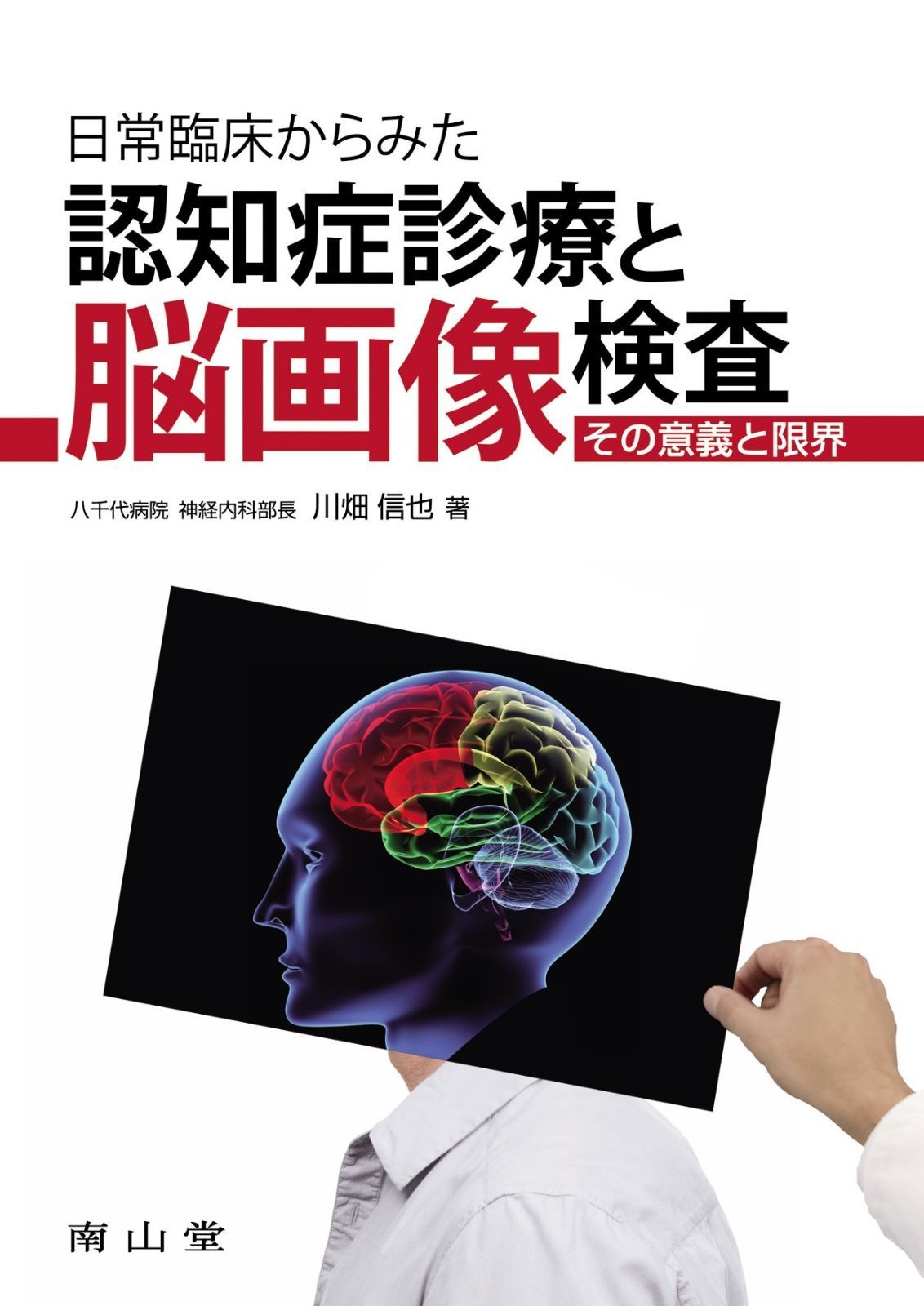 日常臨床からみた認知症診療と脳画像検査-その意義と限界
