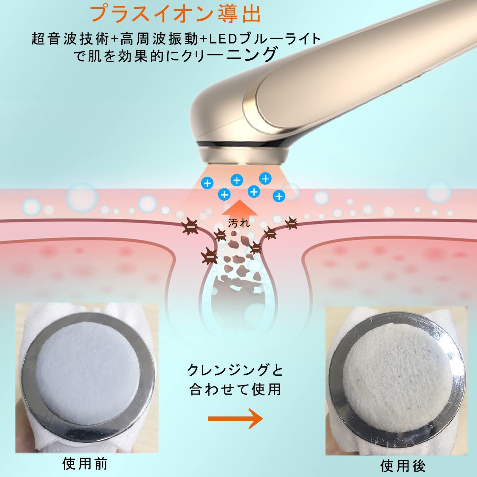 RF美顔器