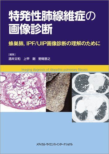 特発性肺線維症の画像診断 蜂巣肺，IPF/UIP画像診断の理解のために 酒井文和、 上甲剛; 野間恵之