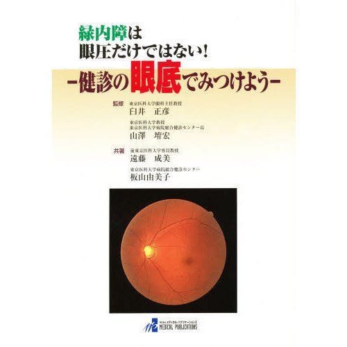 緑内障は眼圧だけではない