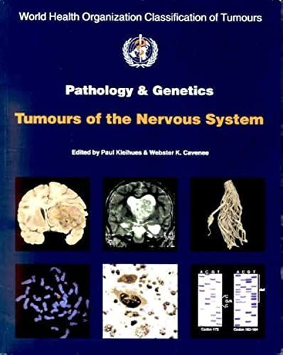 Pathology and Genetics of Tumours of the Nervous System (World Health Organization Classification of Tumours) Kleihues， P.、 Cavene