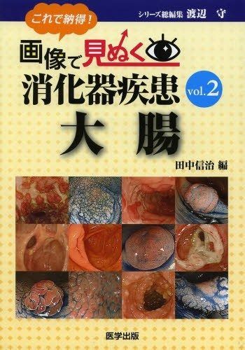これで納得!画像で見ぬく消化器疾患 vol.2