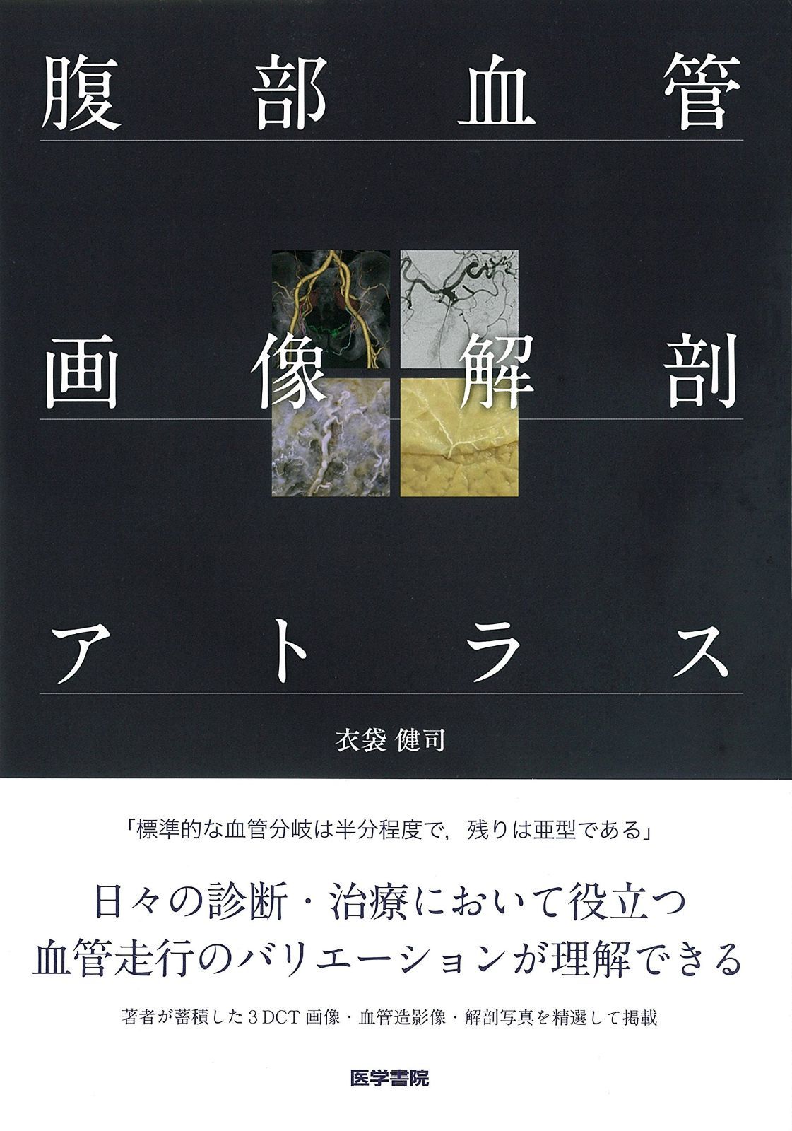 腹部血管画像解剖アトラス 最も安い 腹部血管画像解剖アトラス | 衣袋