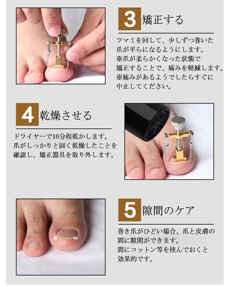 巻き爪　ネイルケア　スターターキット 育爪スターターキット – 育爪ショップ