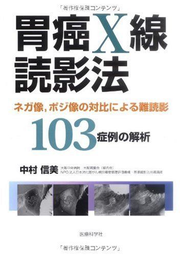 胃癌X線読影法ネガ像，ポジ像の対比による難読影103症例の解析／中村 信美