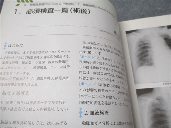 文光堂 専門医のための呼吸器外科の要点と盲点 II 2010 土屋了介 015S3D 専門医のための呼吸器外科の要点と盲点 2 / 土屋 了介【監修