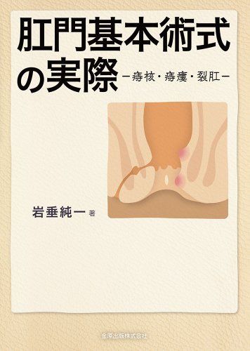 肛門基本術式の実際: 痔核・痔瘻・裂肛 [単行本] 岩垂純一