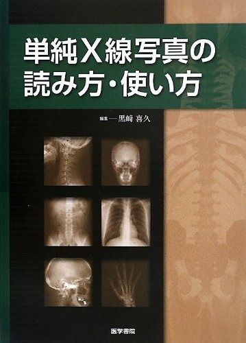 裁断済み　単純X線写真の読み方・使い方 本 単純X線写真の読み方・使い方