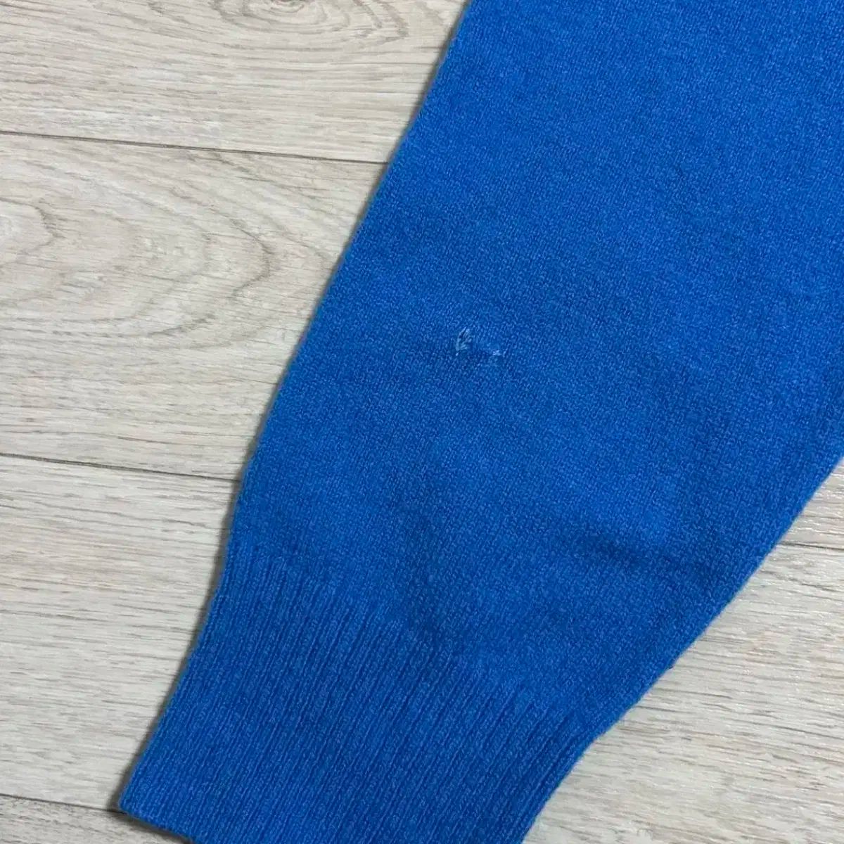 Acne