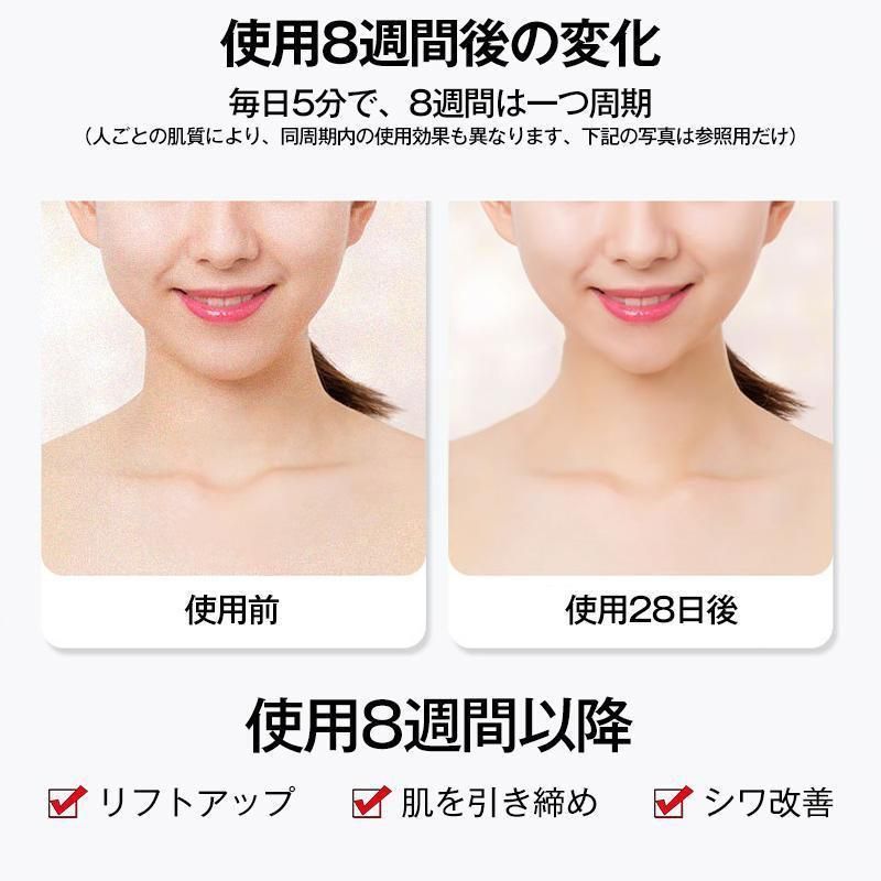 美顔ローラー EMS リフトアップ効果 母の日 美顔器 V顔 小顔