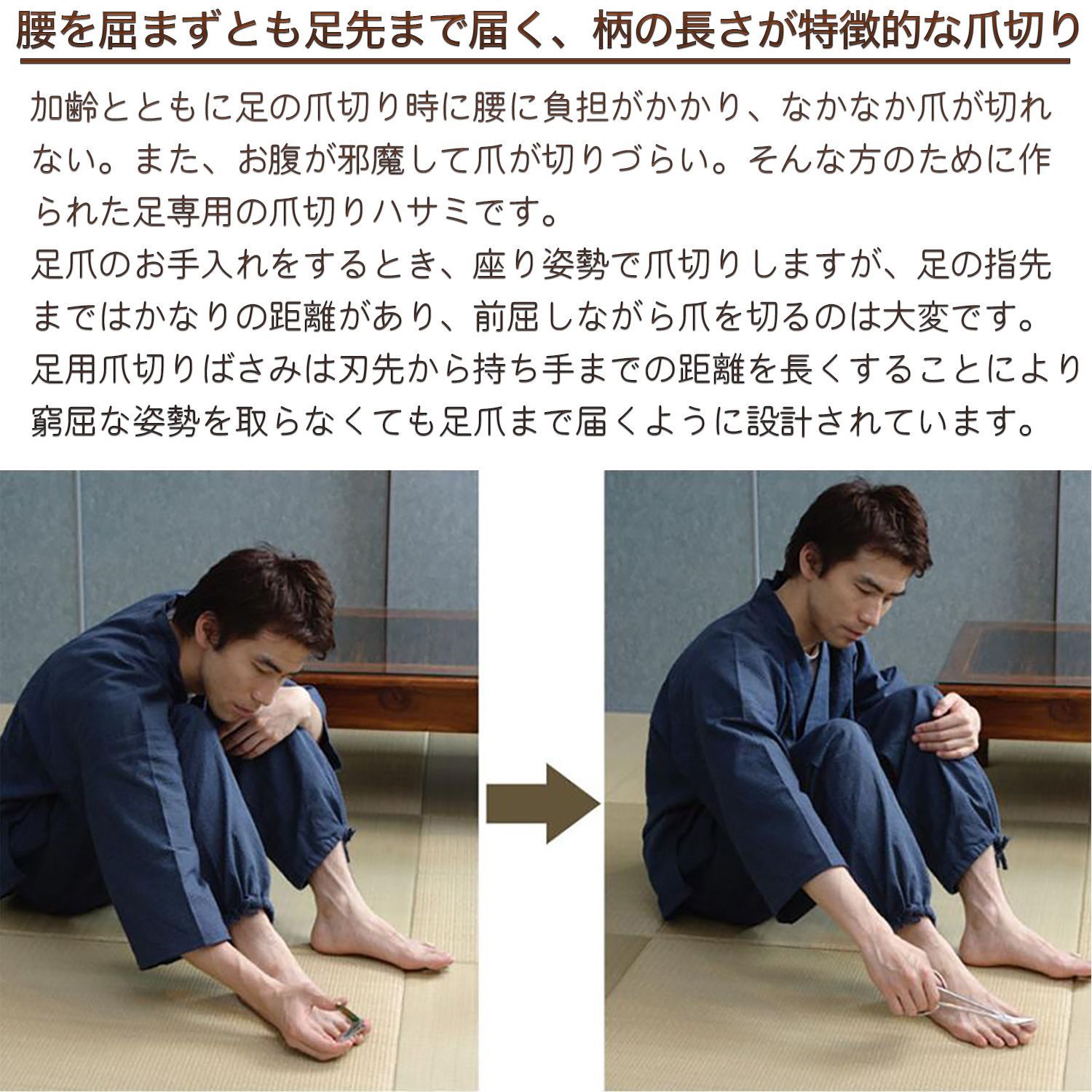 巻き爪