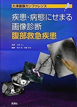 疾患・病態にせまる画像診断 腹部救急疾患 (大津画像カンファレンス)