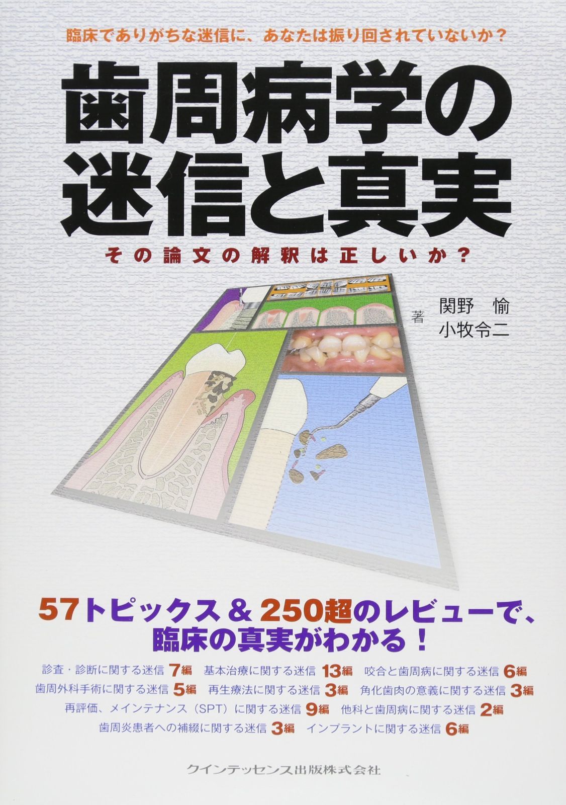 歯周病学の迷信と真実 【公式通販】