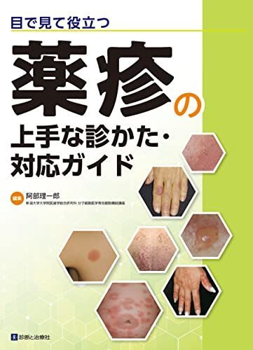 目で見て役立つ 薬疹の上手な診かた・対応ガイド